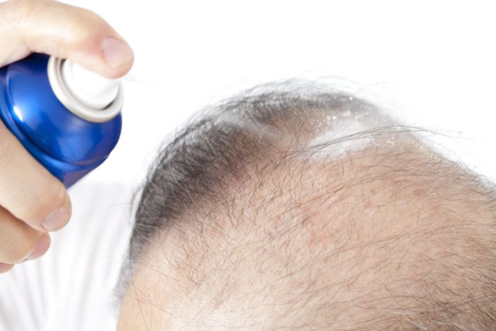 1番手軽に始められるけれど、市販の育毛剤で本当にAGAは治るの?