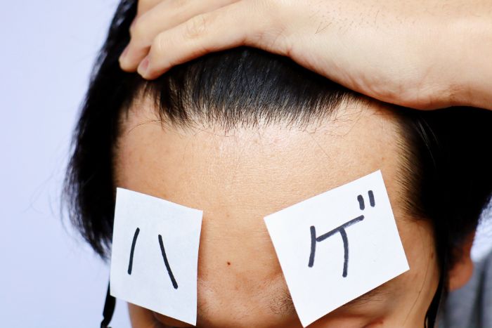 M字ハゲにAGA治療は有効なのか